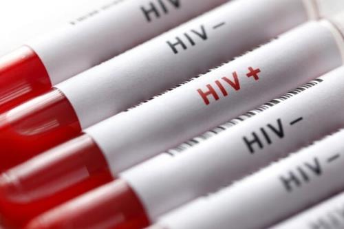 آخرین وضعیت HIV در کشور