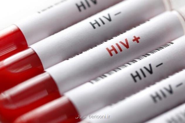 آخرین وضعیت بروز HIV در کشور