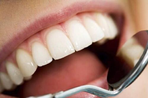 سفارش هایی برای بهداشت دهان و دندان در نوروز