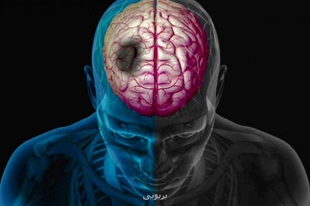 وضعیت بروز سکته مغزی در ایران